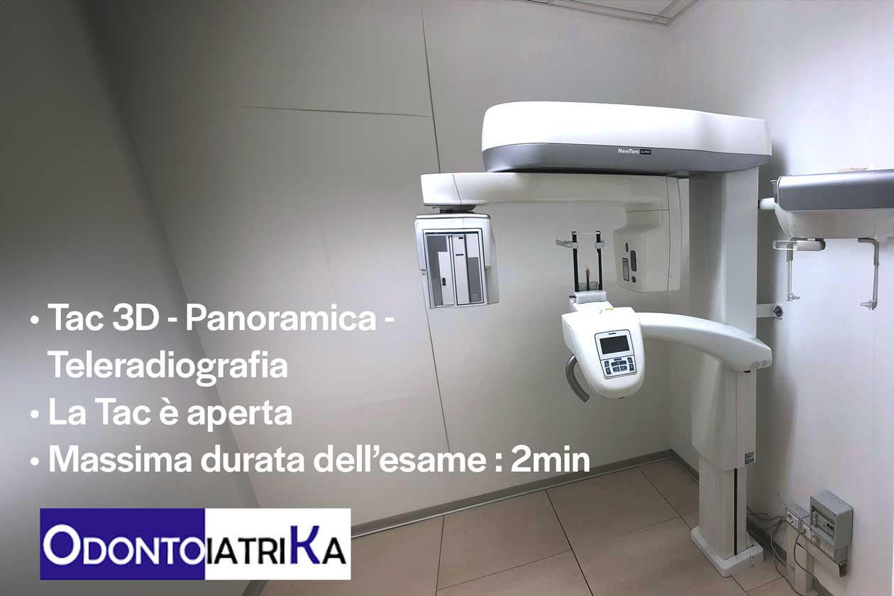 TAC dentale 3D Savona Dentista Odontoiatrika