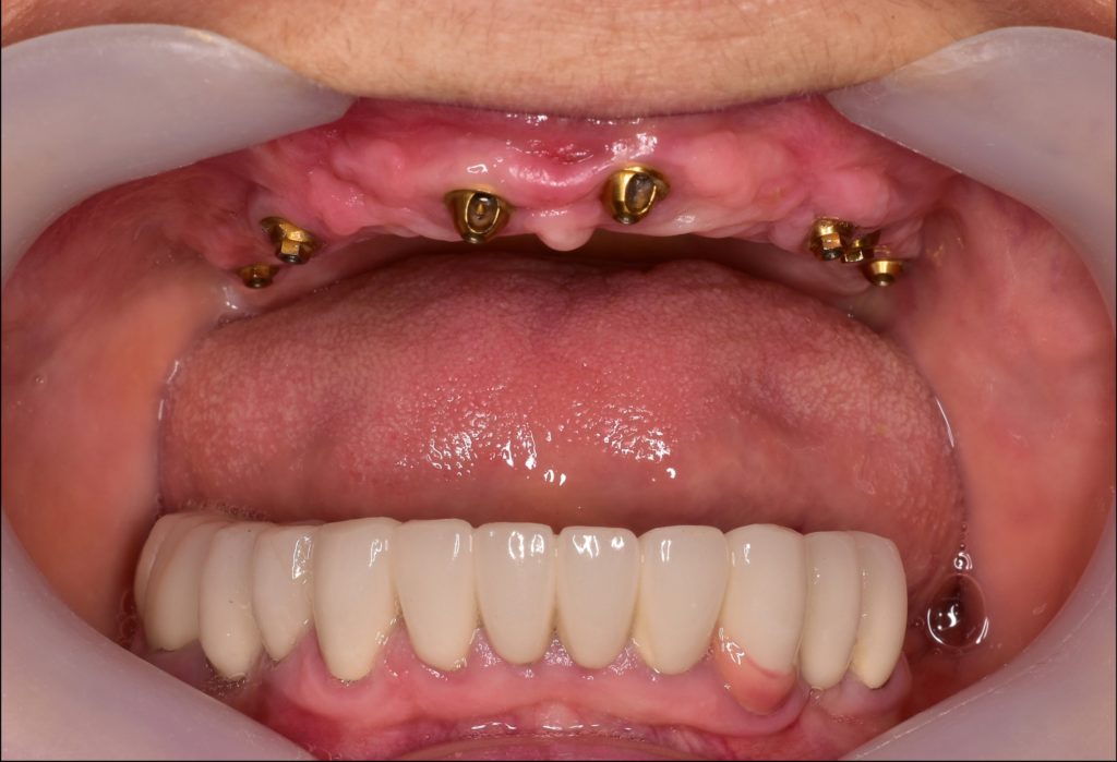 Odontoiatricka prestazione