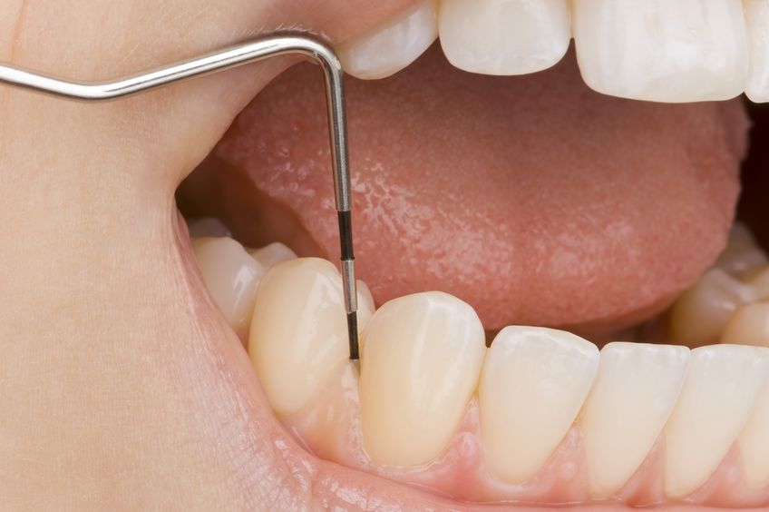 Odontoiatrica Parodontologia